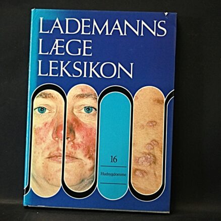 Anders Tuxen, Hudsygdomme