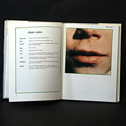 Anders Tuxen, Hudsygdomme - Image 2